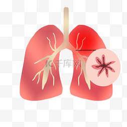 肺部吸氧图片_双肺肺气肿