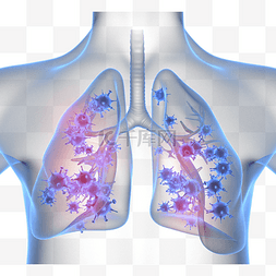 肺部疾病图片_冠状病毒肺部感染3d元素
