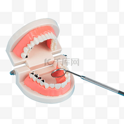 虫牙图片_医疗牙齿虫牙