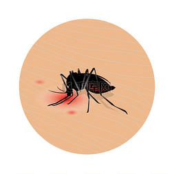 蚊虫叮咬皮肤。
