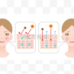 信息图皮肤插图。干燥的皮肤和健