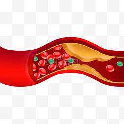 人体血管图图片_血管堵塞动脉血管