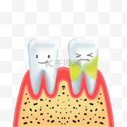 假牙清洁图片_口腔牙齿疾病