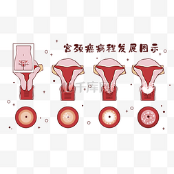 皮下组织横切面图片_医疗人体组织器官宫颈癌