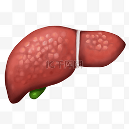 脂肪含量图片_肝脏脏器肝硬化人体器官内脏医疗