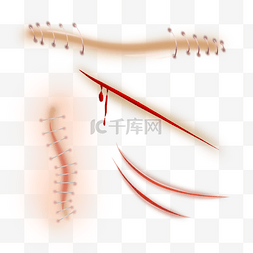 缝合伤口图片_伤口缝合红色医疗卡通