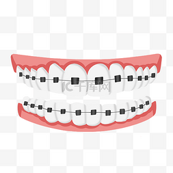 牙科牙齿矫正