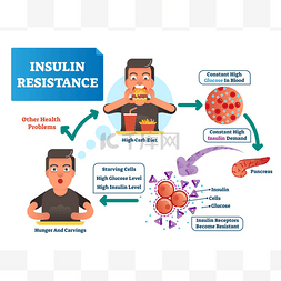 变图片_胰岛素抵抗向量例证。标记方案与