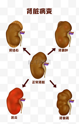 人体全身骨骼图图片_人体医疗组织器官人体肾脏病变