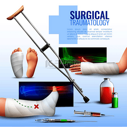 手足综合征图片_外科创伤学的现实概念与手足和腿