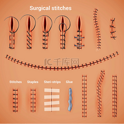 外科缝合缝合逼真的缝合方法和形