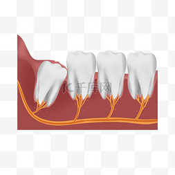 牙齿牙龈口腔立体