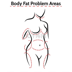 抽脂步骤图片_女性身体脂肪问题区域海报女性身