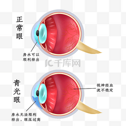 眼部按摩法图片_眼部疾病病变眼睛眼科医疗疾病