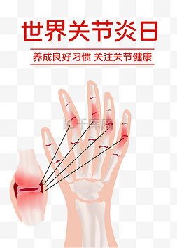 增强骨质图片_世界关节炎日