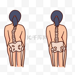 脊椎健康图片_脊柱侧弯矫正健身