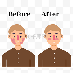 前后机身图片_护肤前后对比图鼻子红肿的男生
