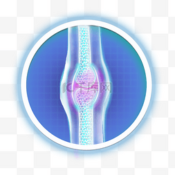 关节骨骼图片_关节受伤科技感半透明模型