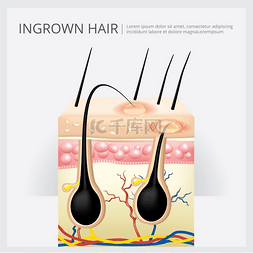 向内生长的头发结构矢量图