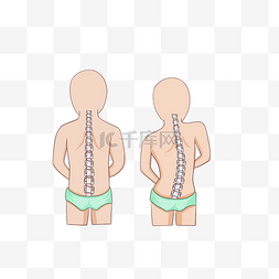 脊柱椎体图片_儿童脊柱侧弯矫正