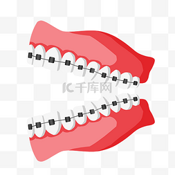 牙口腔护理图片_戴牙套牙齿矫正