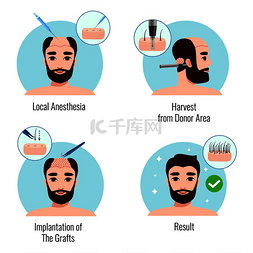 大健康概念图片_大胡子男子在毛发移植手术阶段的
