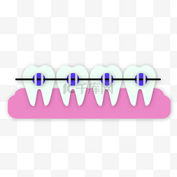 矢量口腔牙齿矫正器