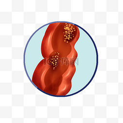 组织器官人体图片_人体内脏器官血管病变