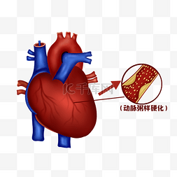 人体医疗组织器官心脏病变