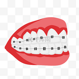牙口腔护理图片_牙科牙齿矫正