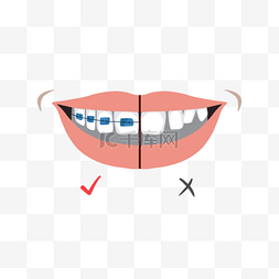牙套矫正牙齿效果对比