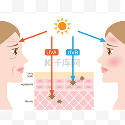 区别图片_信息图皮肤插图。乌瓦射线和Uvb射