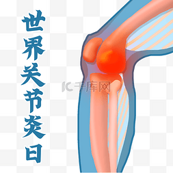 关节周缘疼痛图片_世界关节炎日