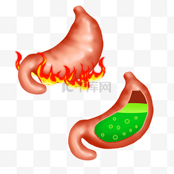 人体器官胃图片_胃部胃酸胃热