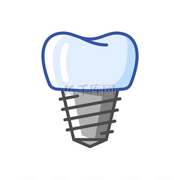 牙齿种植牙图片_种植牙的插图。