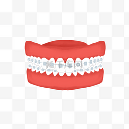 牙套牙齿模型牙齿矫正立体