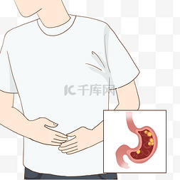 人体组织器官胃部病变医学科普