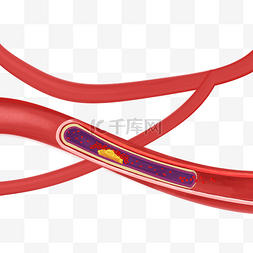人体循环循环图片_人体动脉硬化心血管堵塞