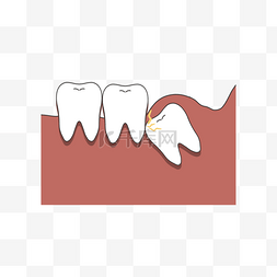 牙齿智齿牙龈口腔