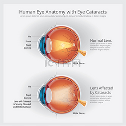 人类眼睛矢量图片_人眼解剖矢量图