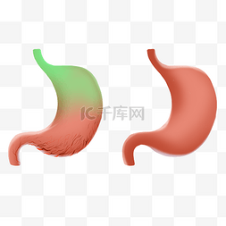 慢性胃炎图片_人体内脏肠胃炎症人体内脏器官医