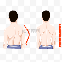 男子图片_男子脊柱侧弯矫正