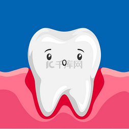 牙龈发炎的病牙插图。