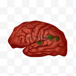 人体医疗组织器官大脑