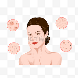 皮肤组织表层图片_女性皮肤问题皮肤状态