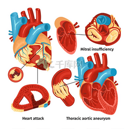 平面图标设置与心脏解剖学和不同
