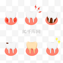 盆腔器官脱垂图片_口腔问题口腔疾病牙齿牙周器官