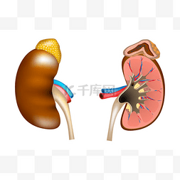 内脏卡通图片_肾脏和肾上腺的结构。人体肾脏医