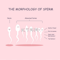 精子的形态
