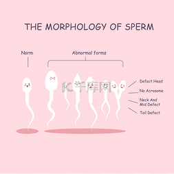 精子畸形图片_精子的形态